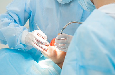 大学病院に所属している口腔外科医が痛みの少ない治療を行う